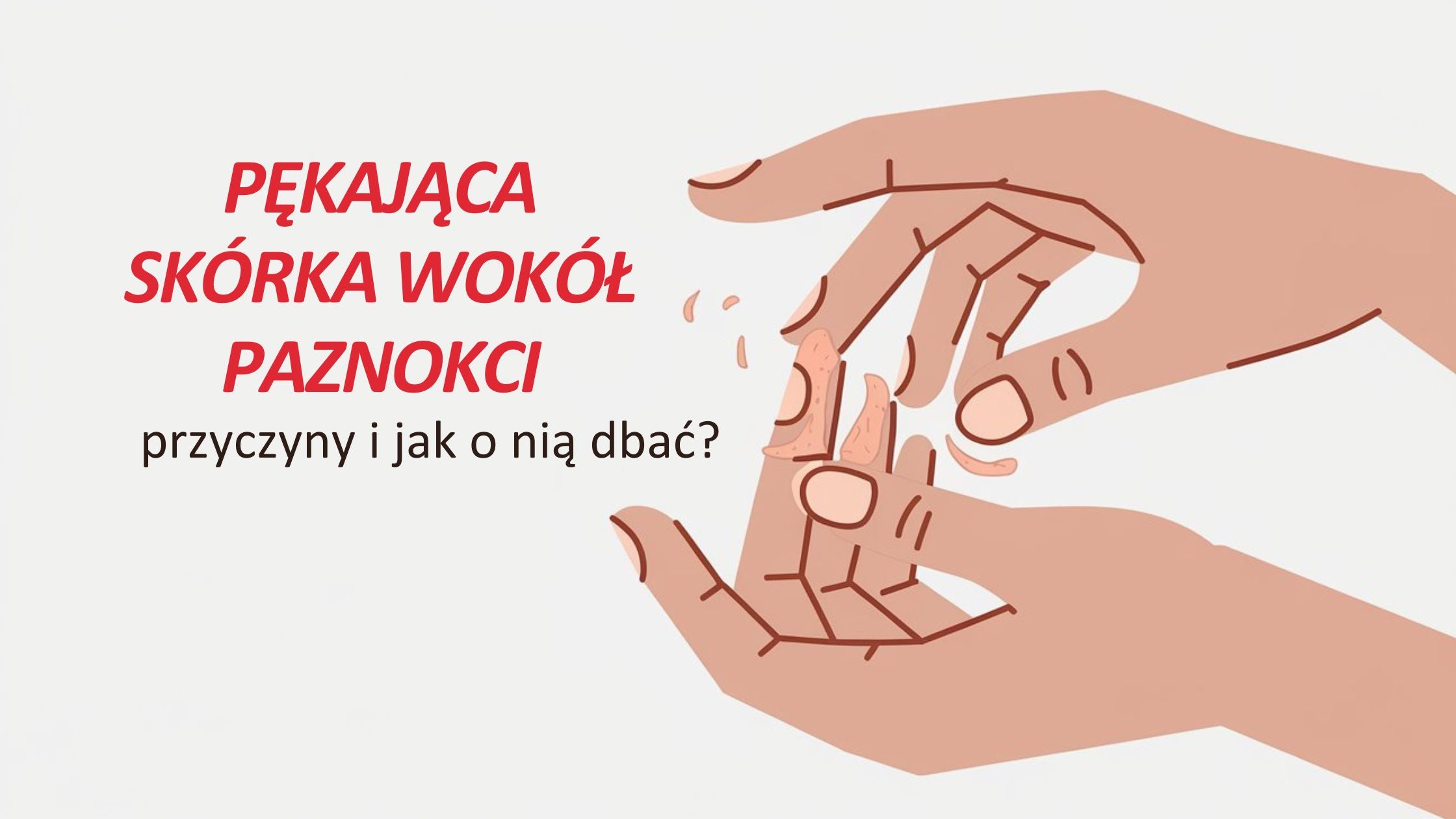 Pękająca skórka wokół paznokci – przyczyny i jak o nią dbać?