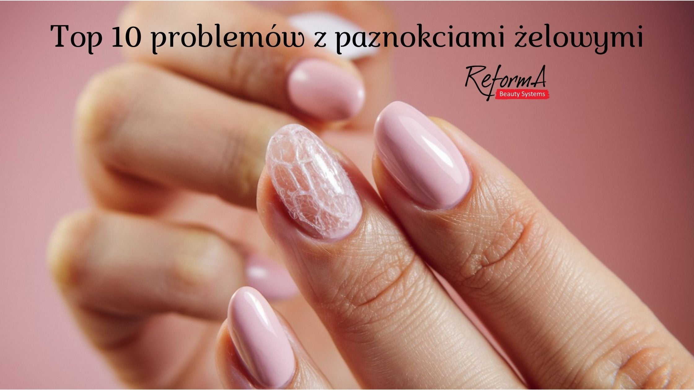 Top 10 problemów z paznokciami żelowymi