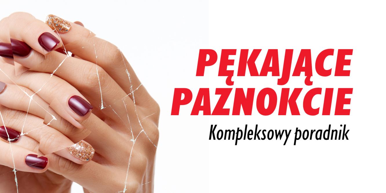 Pękające paznokcie: kompleksowy poradnik zapobiegania i leczenia