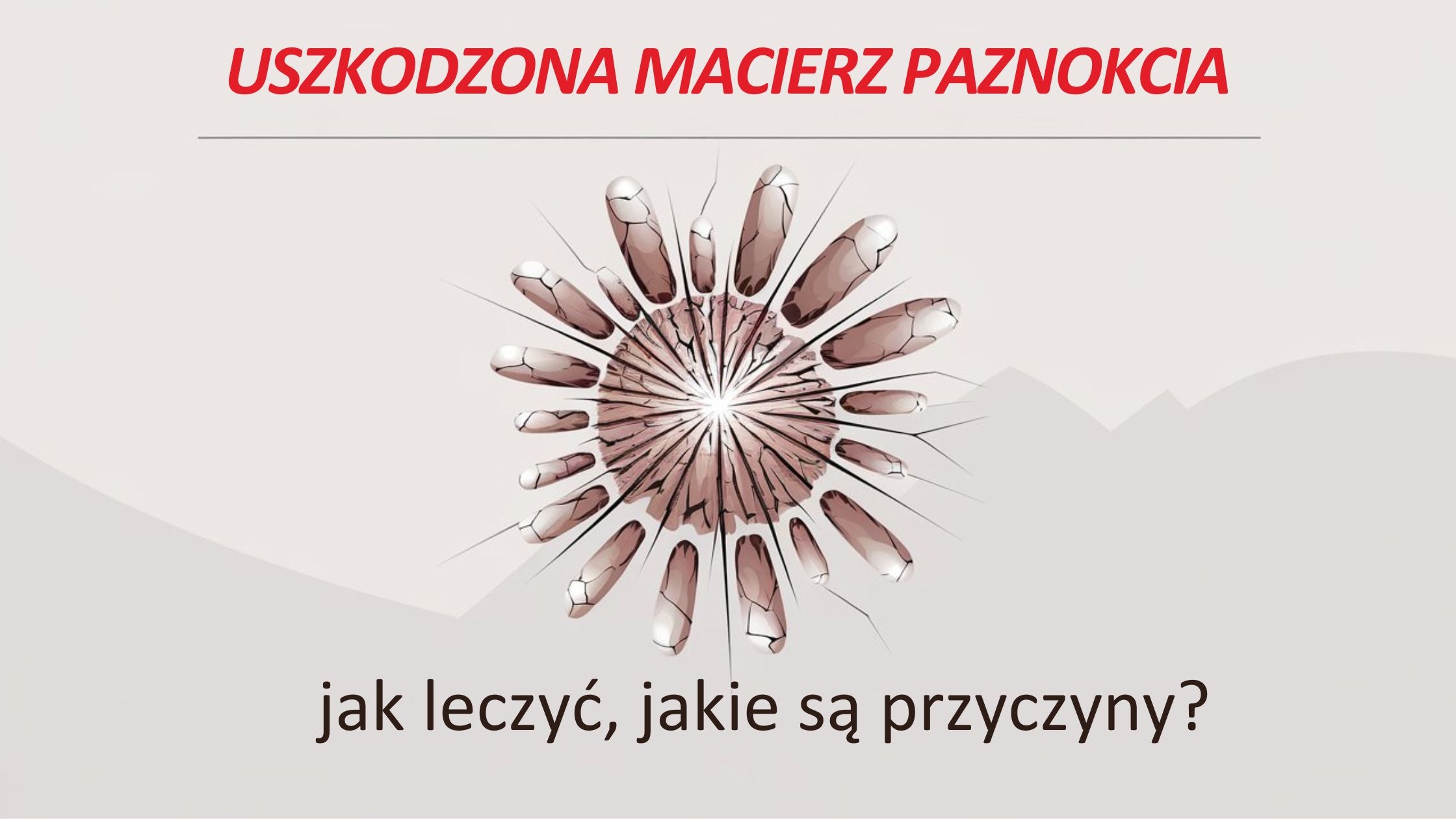 Uszkodzona macierz paznokcia – jakie są przyczyny i jak leczyć?